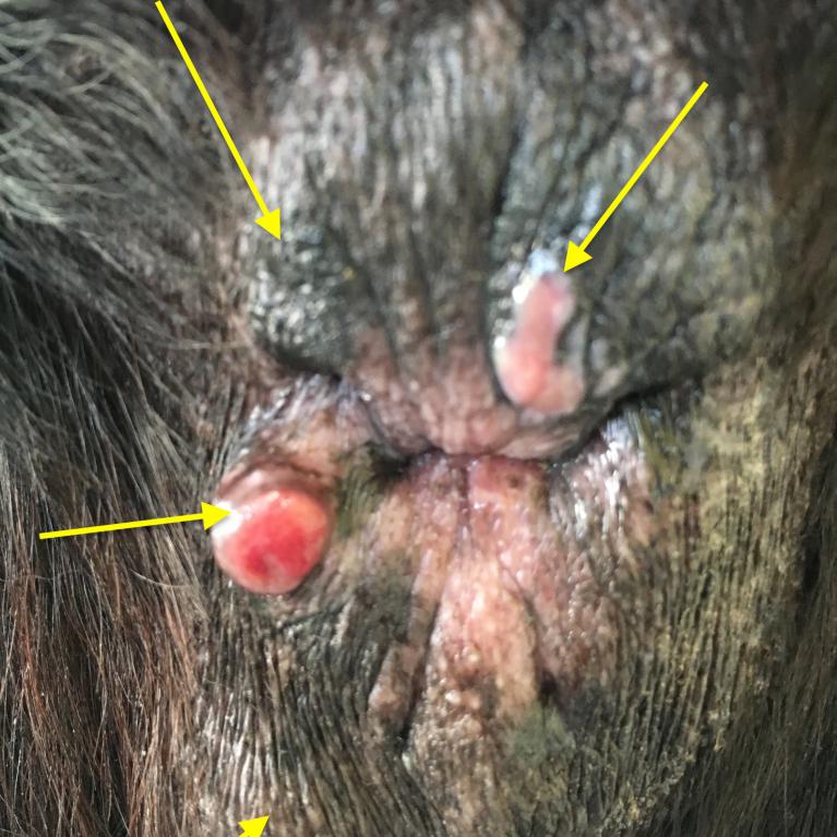 Circumanalum sur le pourtour de l'anus: motif de castration