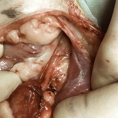 Abouchement de l'uretère à la vessie